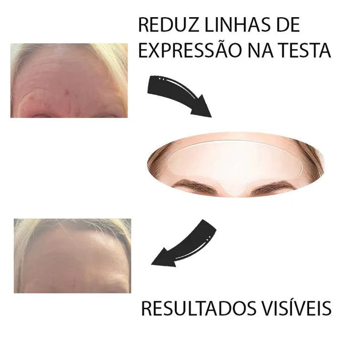 Adesivo Anti Sinais e Linhas de Expressão Young Beauty